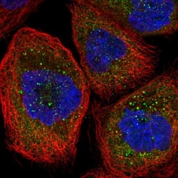 KCC3/SLC12A6 Antibody, Novus Biologicals:Antibodies:Primary Antibodies